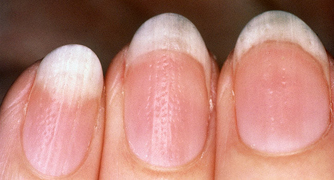CBD y cuidado de las uñas